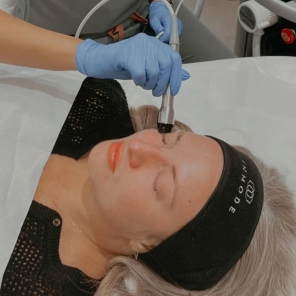 5 Reasons You Should Try Radio Frequency Eye Treatment